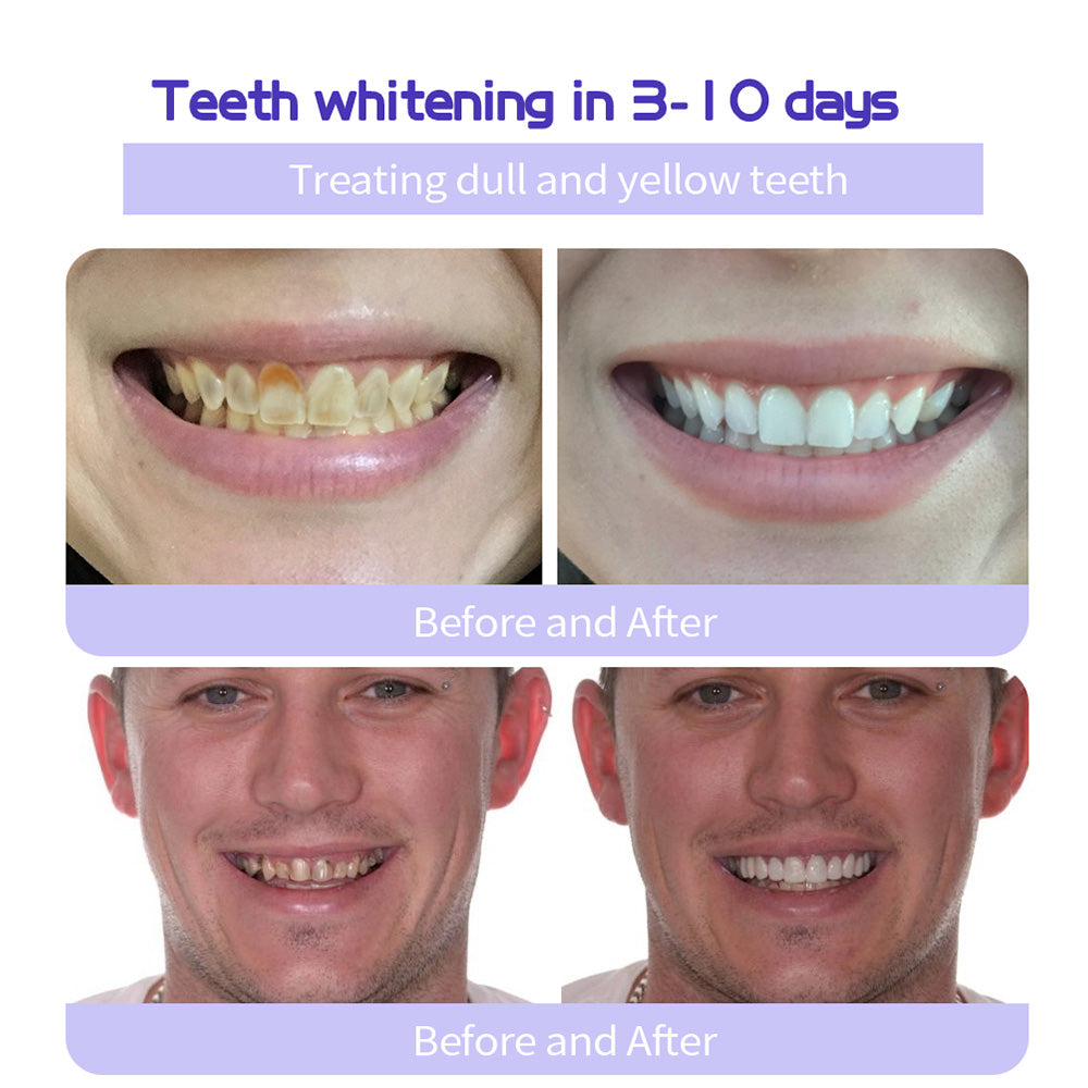 QIAWI™TeethRestoration Mineral Powder🦷Obtain American Dental Association (ADA) Certification (Treats periodontitis and mouth ulcers, prevents tooth loss, and repairs gum recession）