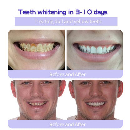 QIAWI™TeethRestoration Mineral Powder🦷Obtain American Dental Association (ADA) Certification (Treats periodontitis and mouth ulcers, prevents tooth loss, and repairs gum recession）