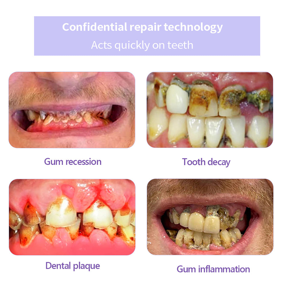 QIAWI™TeethRestoration Mineral Powder🦷Obtain American Dental Association (ADA) Certification (Treats periodontitis and mouth ulcers, prevents tooth loss, and repairs gum recession）