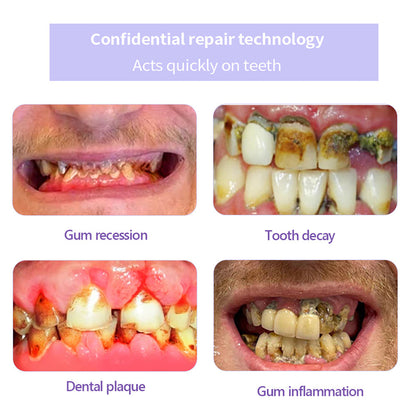 QIAWI™TeethRestoration Mineral Powder🦷Obtain American Dental Association (ADA) Certification (Treats periodontitis and mouth ulcers, prevents tooth loss, and repairs gum recession）
