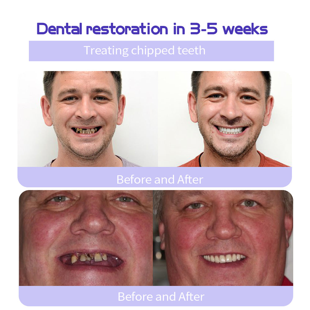 QIAWI™TeethRestoration Mineral Powder🦷Obtain American Dental Association (ADA) Certification (Treats periodontitis and mouth ulcers, prevents tooth loss, and repairs gum recession）