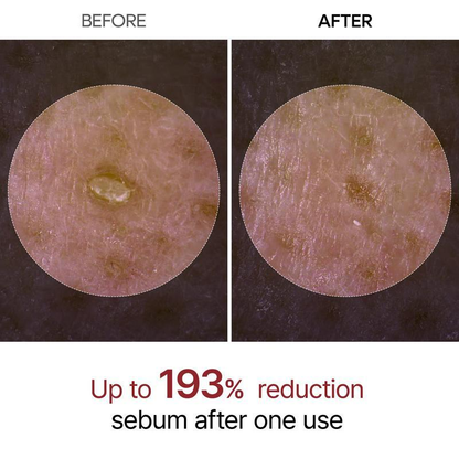 Sale Happening Now:70%OFF🔥 Dr.Melaxin Peel Shot Glow Rice Ampoule Duo